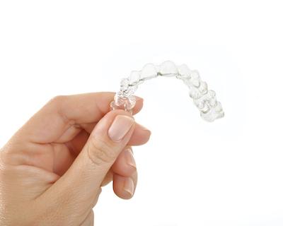A photo of Invisalign Near Me