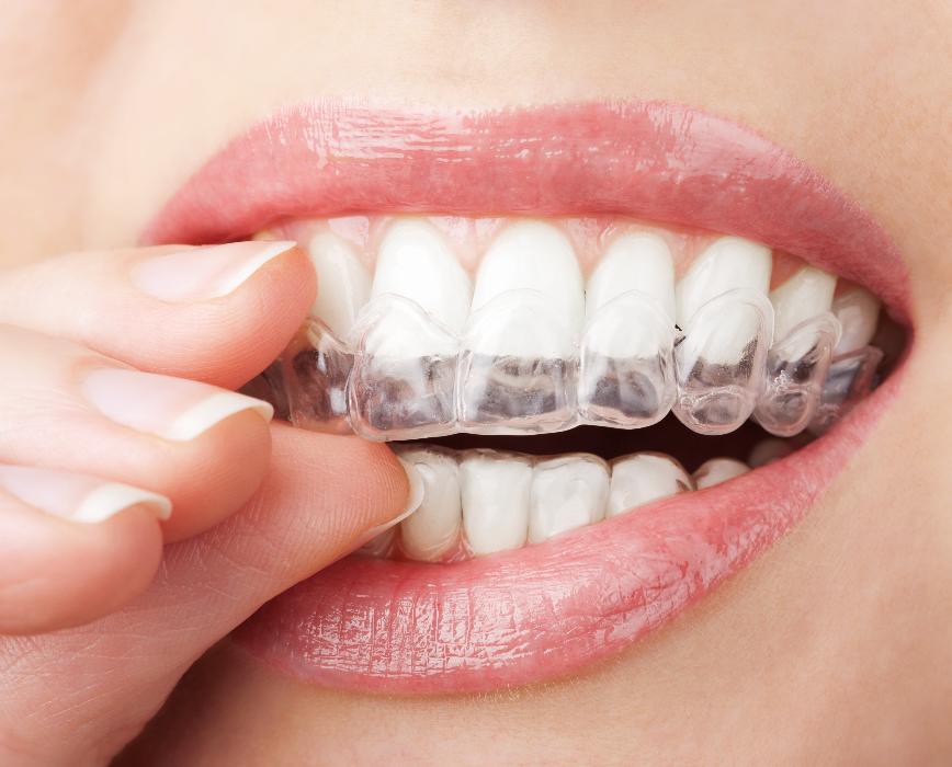 A photo of Invisalign in Randolph, NJ