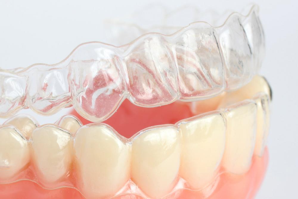 close up of Invisalign clear aligners