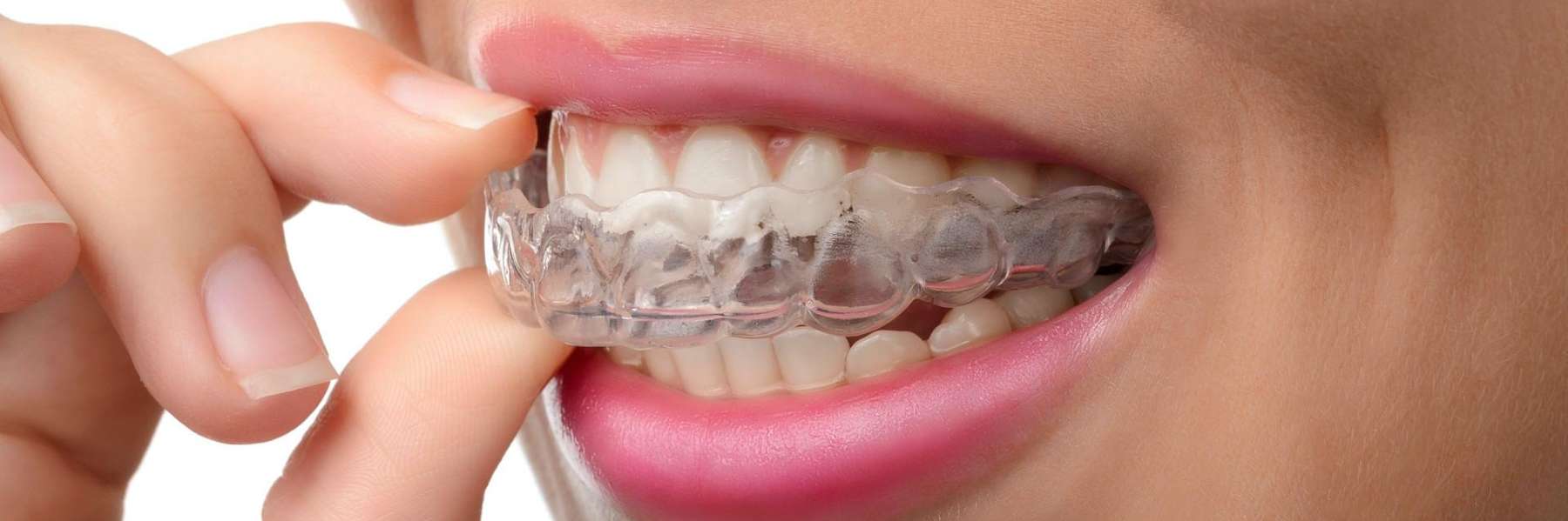 a patient putting on Invisalign in Randolph, NJ