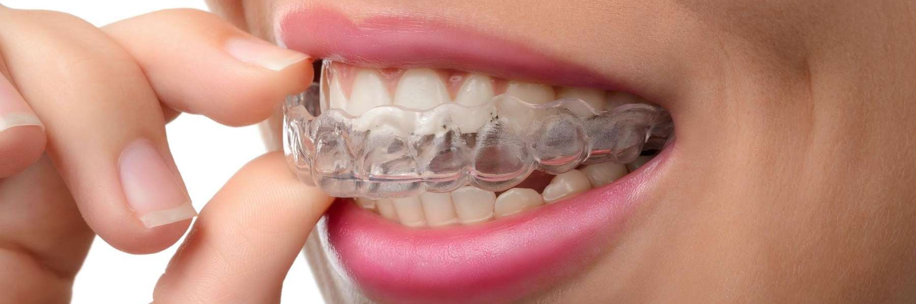 a patient putting on Invisalign in Randolph, NJ