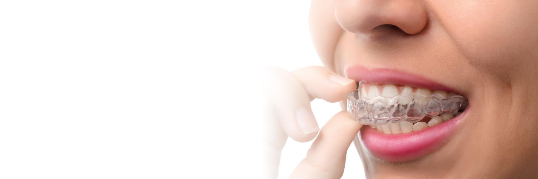 close up of woman using Invisalign clear aligners